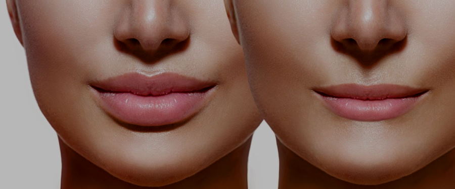 make-your-lips-look-bigger